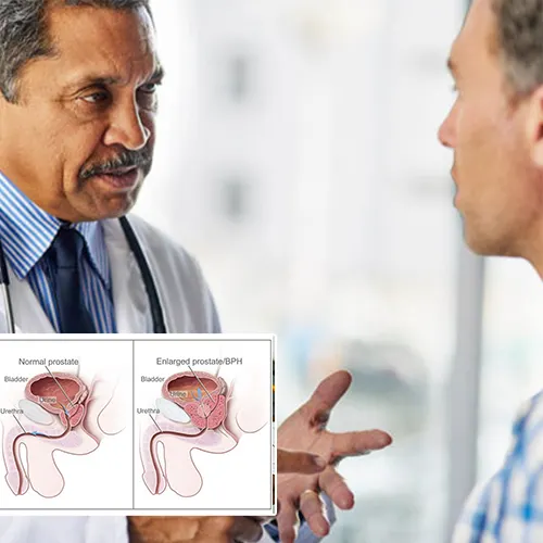 Welcome to  Urology Centers of Alabama 
, Your Trusted Source for Penile Implant Solutions