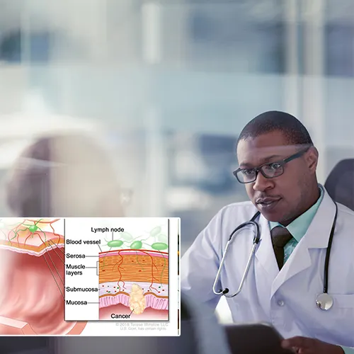 Setting the Standard in Patient Education and Informed Decision-Making