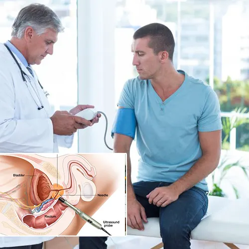 Penile Implant Surgery: The Process Explained