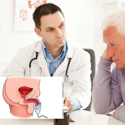 Welcome to Urology Centers of Alabama

, Home of Expert Penile Implant Surgery