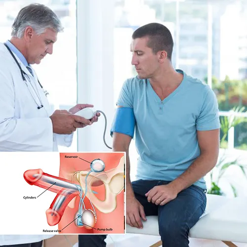 Why Men Worldwide Choose Urology Centers of Alabama

 for Penile Implant Surgery