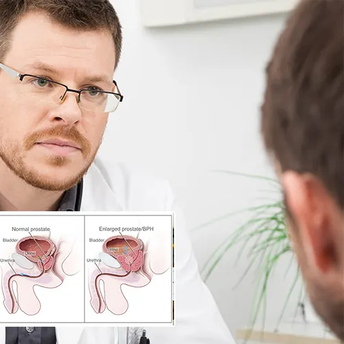 Experience the  Urology Centers of Alabama 
Difference