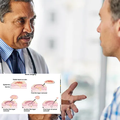 Understanding Penile Implants with  Urology Centers of Alabama 
